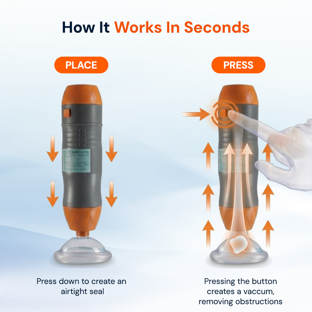 One-Button Anti-Choking Rescue Device Kit