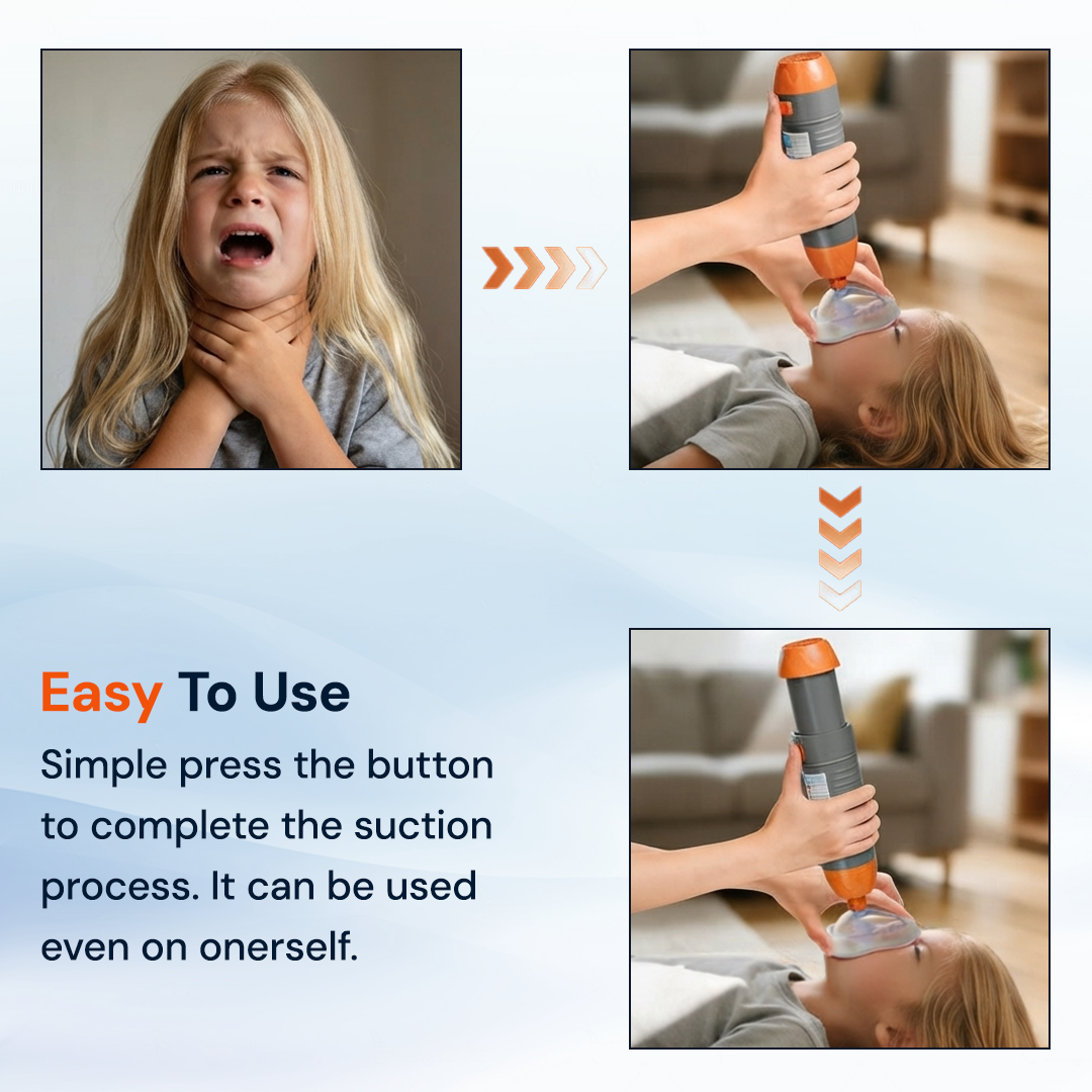 One-Button Anti-Choking Rescue Device Kit